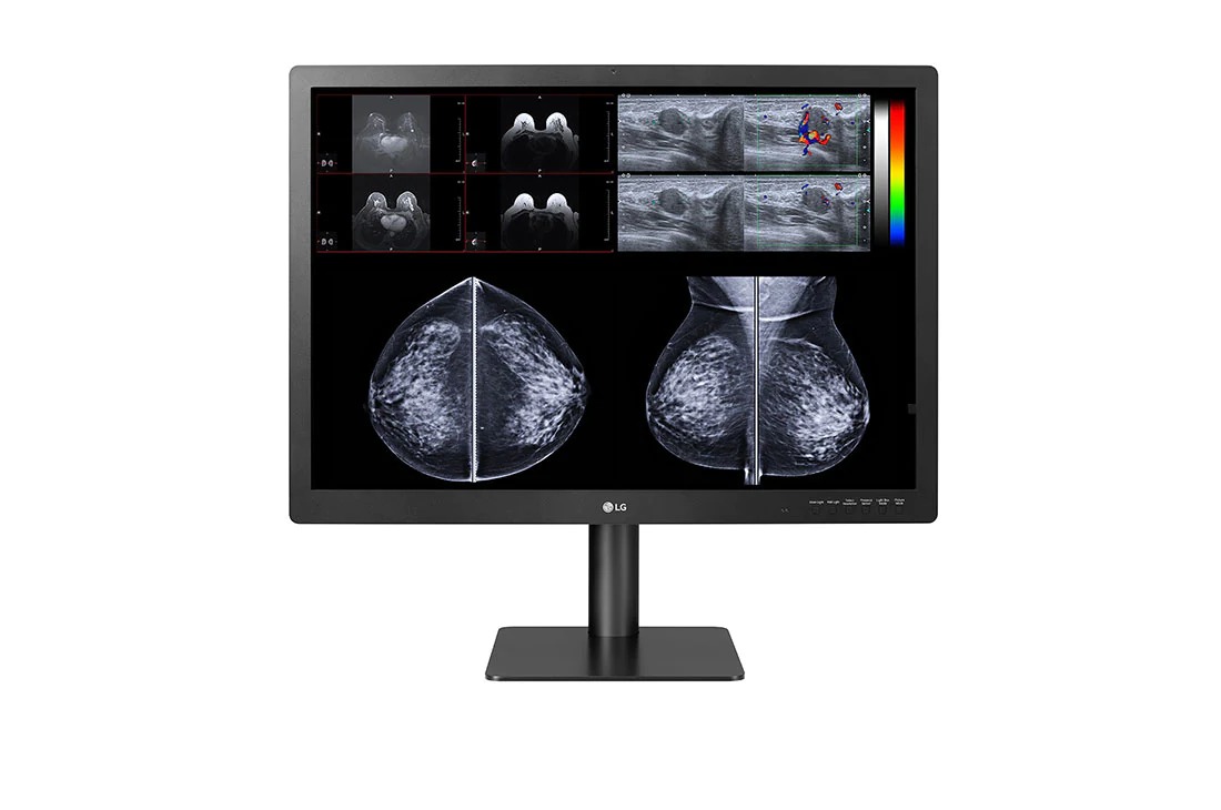 LG 31” IPS 12MP Diagnostic Monitor for Mammography